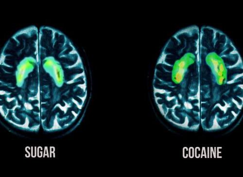 Uno studio dimostra che: Lo zucchero crea dipendenza come la cocaina